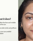 AGE-LESS Under Eye Serum For Dark Circles - Lineless Eye Complex 15ml