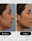 AGE-LESS Anti-aging Face Sculpting Mask - Face Mask for Sagging Skin 50gm