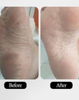 AGE-LESS Anti-aging Feet Softening Cream (50g)