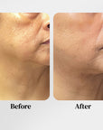 AGE-LESS Lift & Firm - Best Face Tightening Serum 30ml