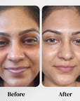AGE-LESS Under Eye Serum For Dark Circles - Lineless Eye Complex 15ml