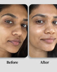 AGE-LESS Intense Dark Spot Remover - Fading Serum: Dark Spot Removal Serum 50ml