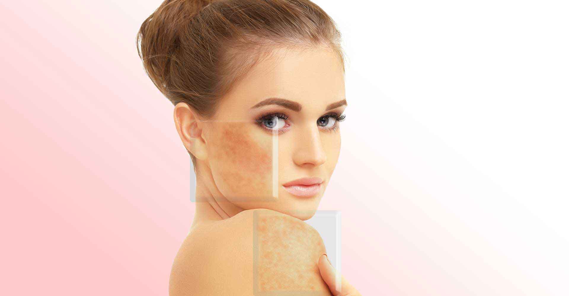 Make those dark spots disappear in a jiffy!
