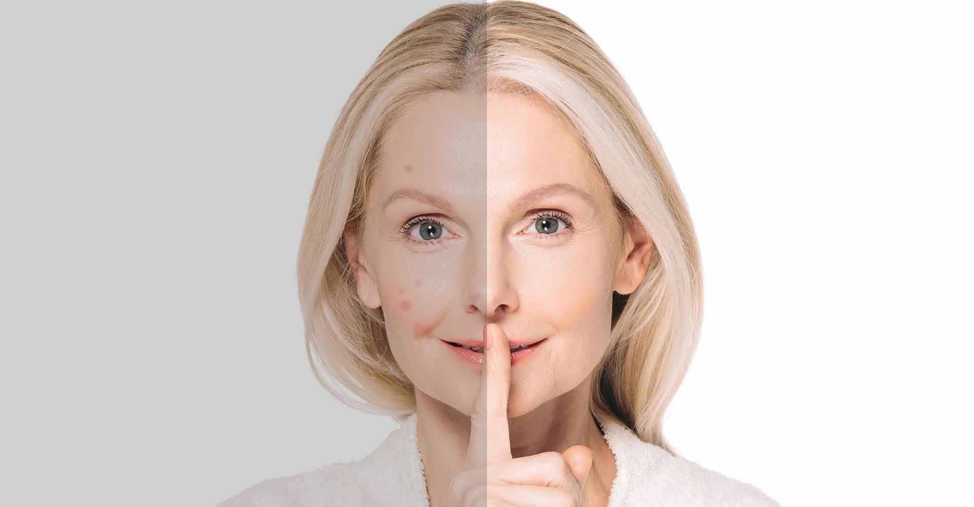 Tips to Get the Best Skin in Your 40's
