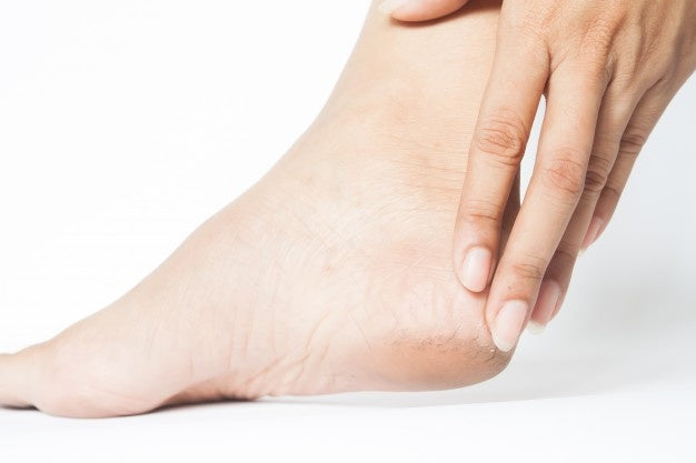5 tips to quick-fix thick dead skin on your feet!