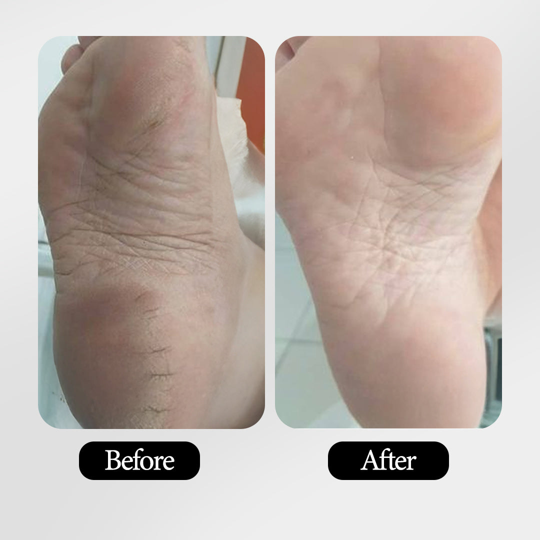 AGE-LESS Anti-aging Feet Softening Cream (50g)