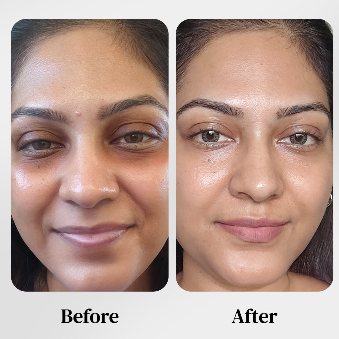 AGE-LESS Under Eye Serum For Dark Circles - Lineless Eye Complex 15ml