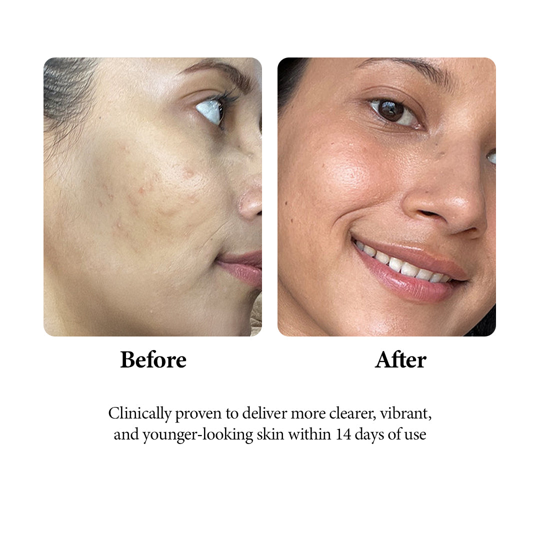 AGE-LESS Papaya Brightening Cleanser - Natural Anti-aging Face Wash (100ml / 200ml)